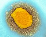 O que já se sabe sobre o surto de varíola dos macacos